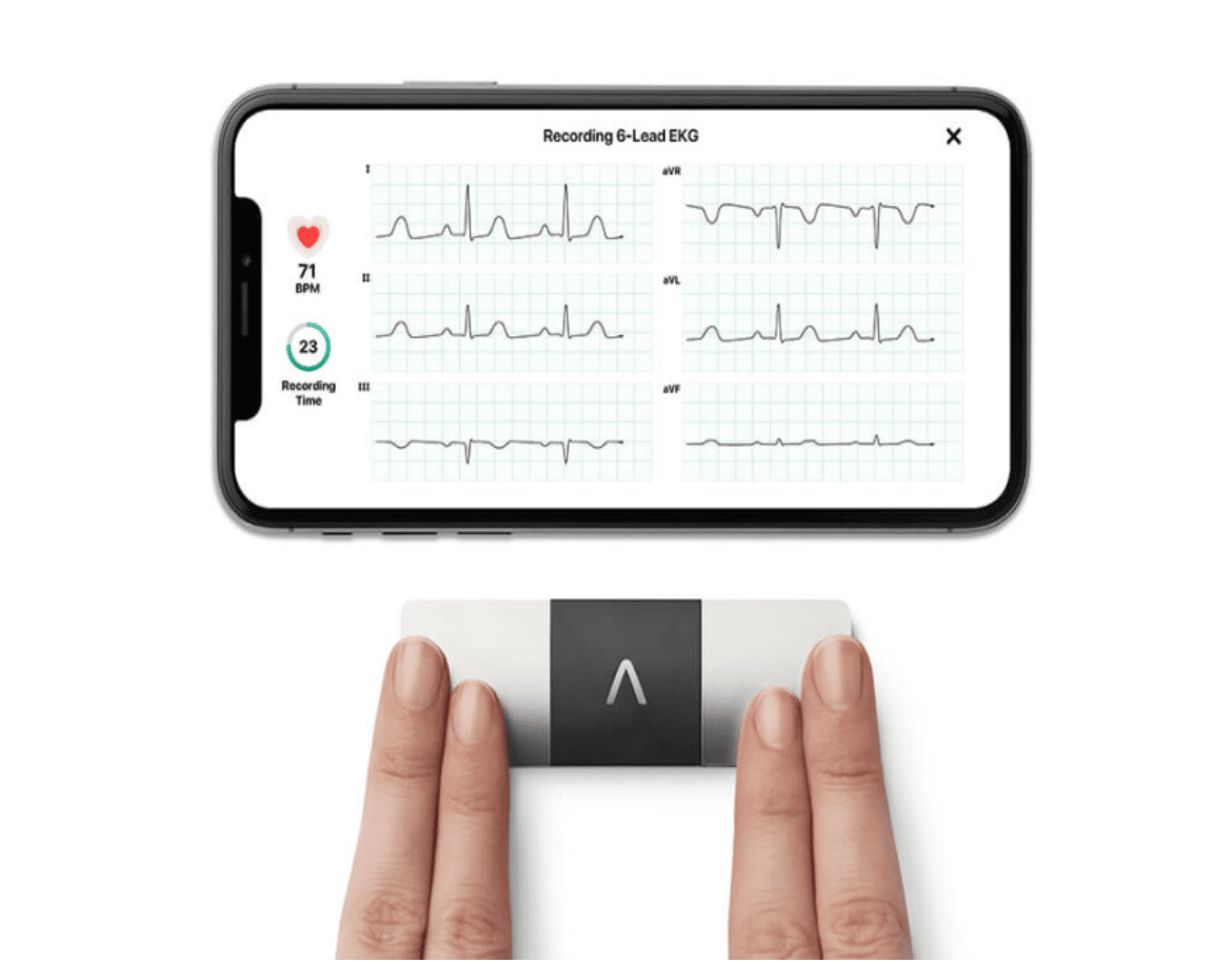 Mobile ECG