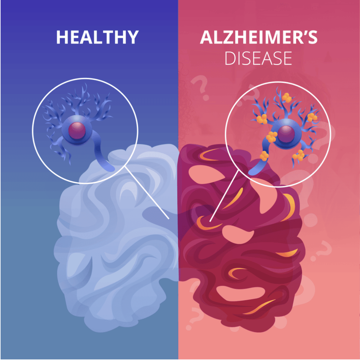 Treatable Alzheimer's